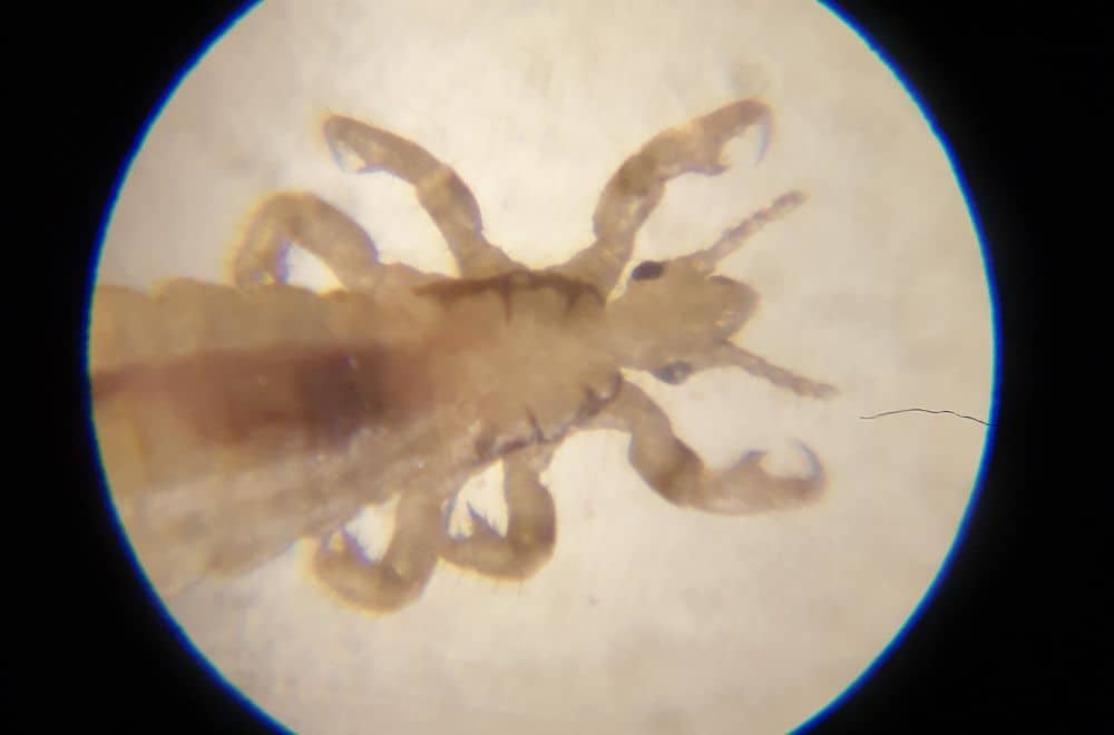 Pubic Lice aka Crabs1