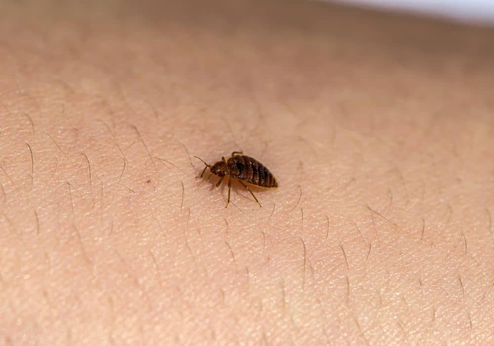Are bed bug bites dangerous 1